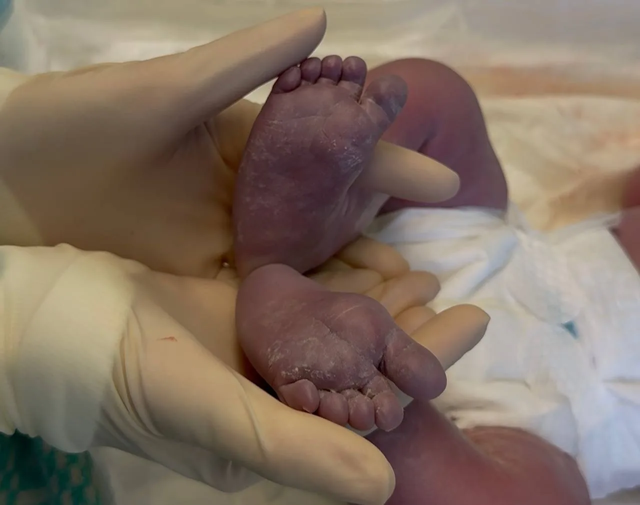 Врачи перинатального центра провели ювелирное кесарево сечение и подарили калининградке седьмого ребенка Врачи перинатального центра провели ювелирное кесарево сечение и подарили калининградке седьмого ребенка